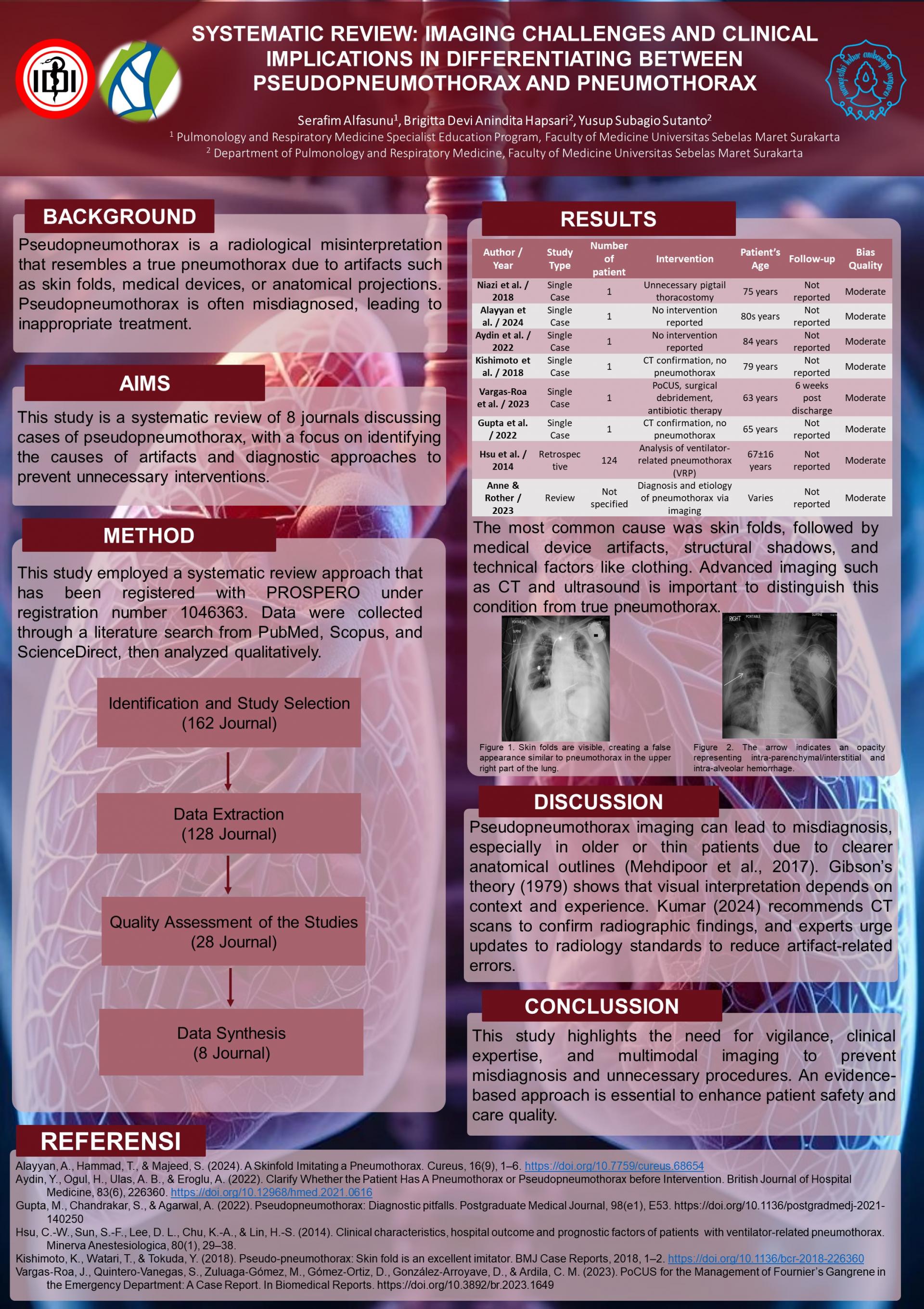 SYSTEMATIC REVIEW: IMAGING CHALLENGES AND CLINICAL IMPLICATIONS IN DIFFERENTIATING BETWEEN PSEUDOPNEUMOTHORAX AND PNEUMOTHORAX