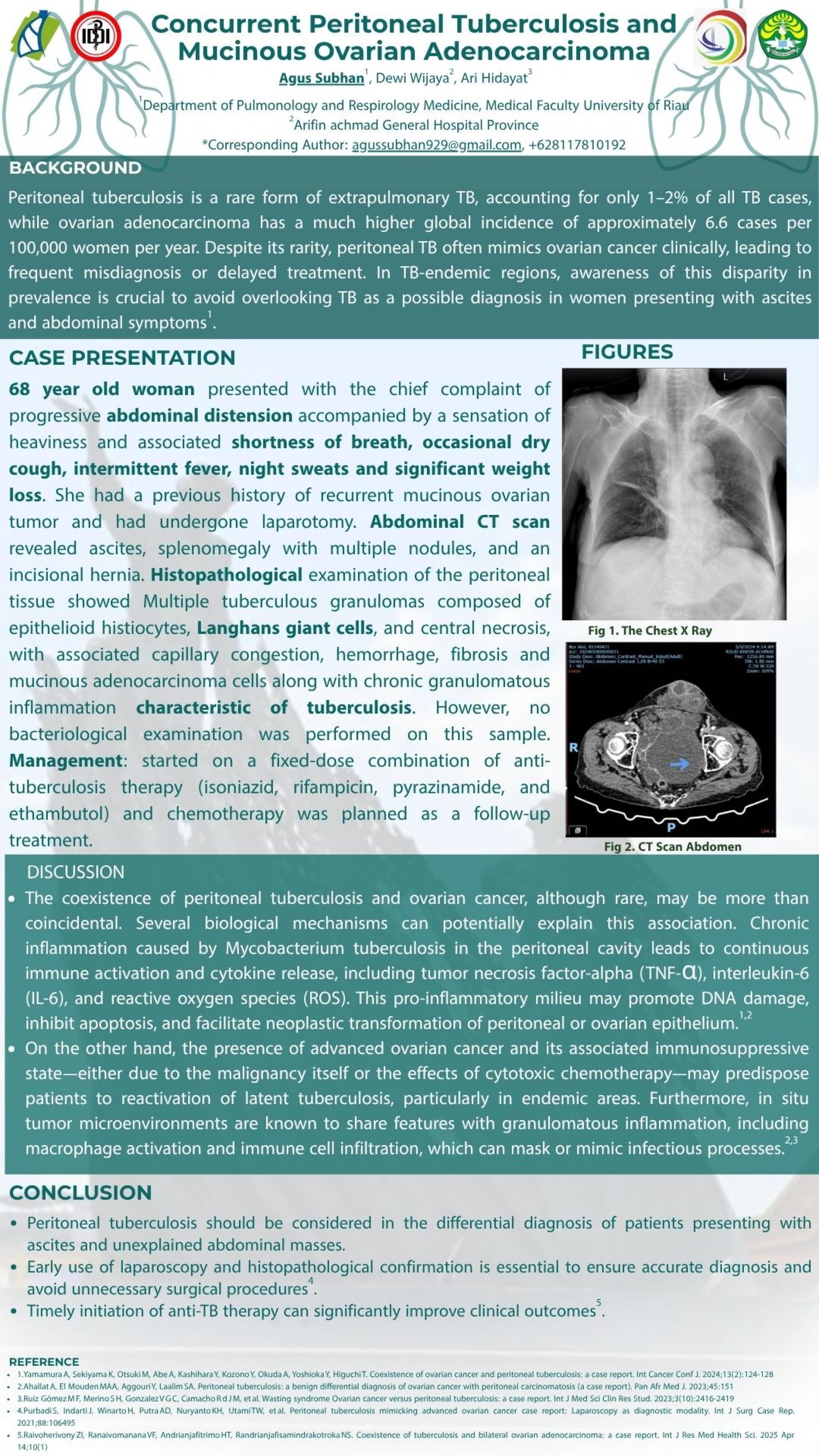 CONCURRENT PERITONEAL TUBERCULOSIS AND MUCINOUS OVARIAN ADENOCARCINOMA