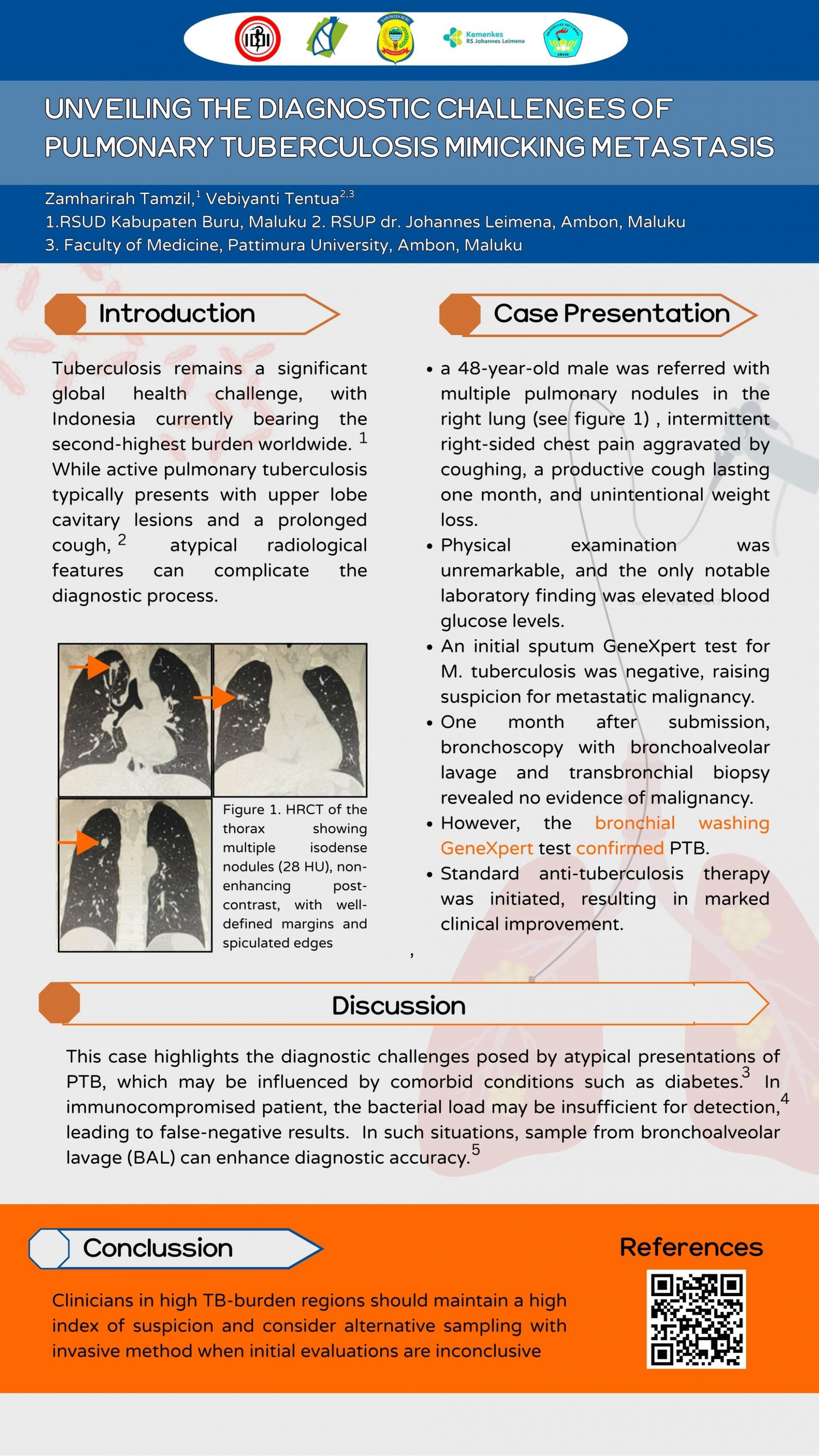 UNVEILING THE DIAGNOSTIC CHALLENGES OF PULMONARY TUBERCULOSIS MIMICKING METASTASIS